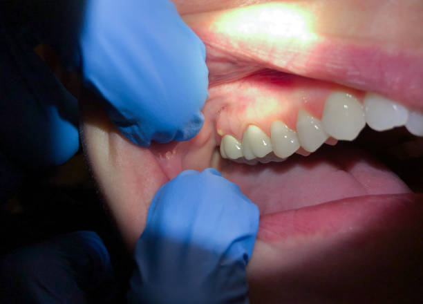 Best Urgent Care for Lost Fillings or Crowns in Cove Creek, NC