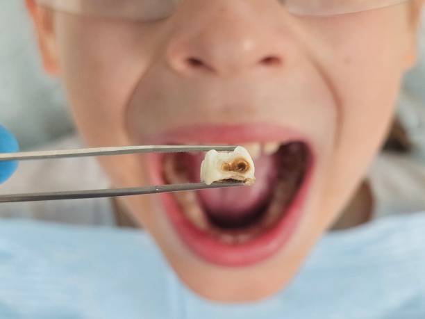 Best Emergency Gum Treatment in Cove Creek, NC