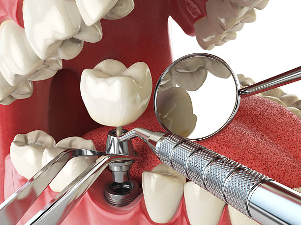 Best Emergency Dental Care for Broken or Chipped Teeth in Cove Creek, NC